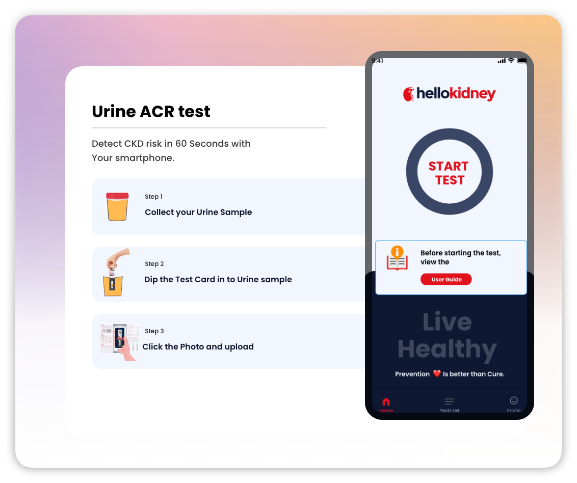 Urine ACR Test